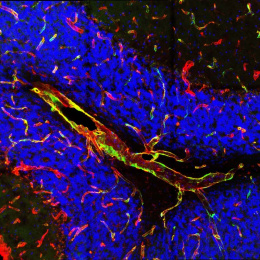 a close-up view of blue-stained cells against a wispy collection of elongated cells