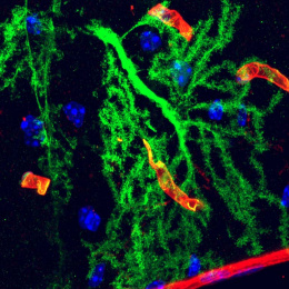 fluorescent green fern-like cells intersect snippets of red vessels against a black background