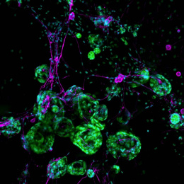 green and purple cells in defined clusters