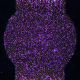 a column of purple mesh like cells, bulging in the middle and tapering at the top