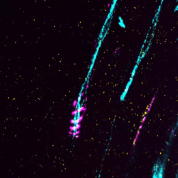 a curling protein (in magenta) spirals around a long thin bundle of axons (in cyan)