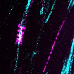 a curling protein (in magenta) spirals around a long thin bundle of axons (in cyan)