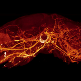 Nervous system visually looking like bright red root like structures in a black background 1